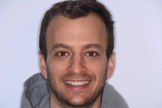 Photo of close-up teeth